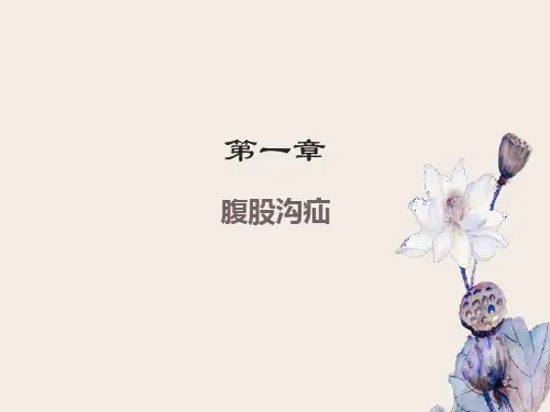 腹股沟疝(课件)