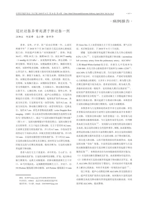 冠状动脉异常起源于肺动脉一例