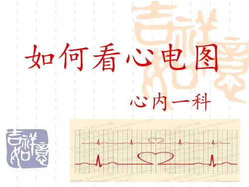 如何看心电图PPT课件