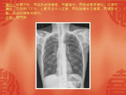 常见40张X片读片及诊断