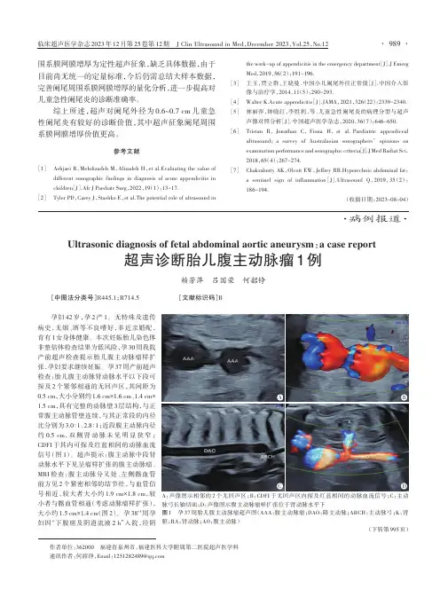 超声诊断胎儿腹主动脉瘤1例