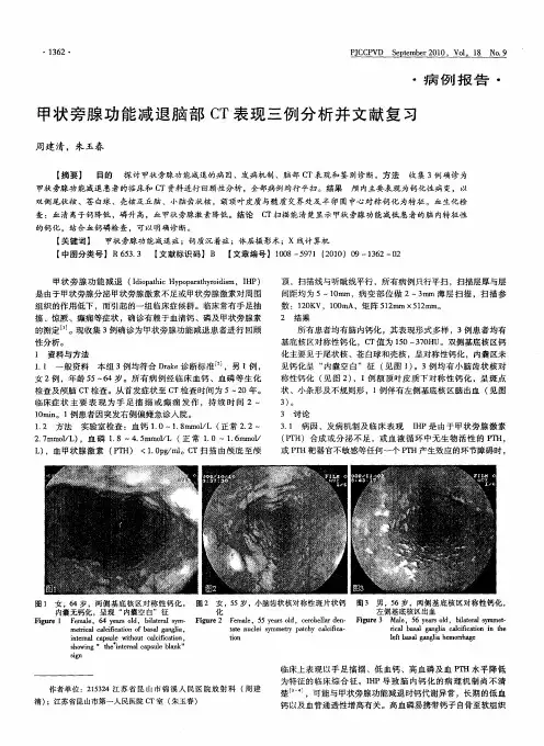 甲状旁腺功能减退脑部CT表现三例分析并文献复习