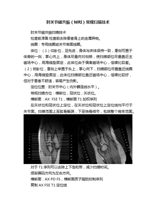 肘关节磁共振（MRI）常规扫描技术