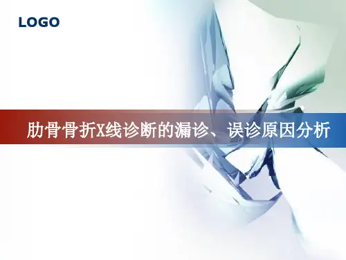 肋骨骨折的影像学表现ppt课件