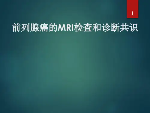 前列腺癌MRI的检查与诊断共识PPT课件