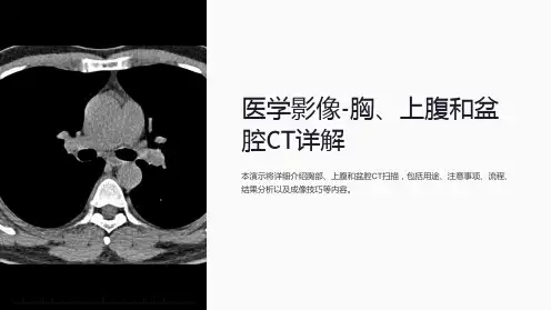 医学影像-胸、上腹和盆腔CT详解