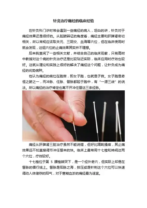 针灸治疗痛经的临床经验