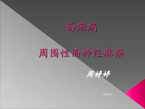 面瘫病