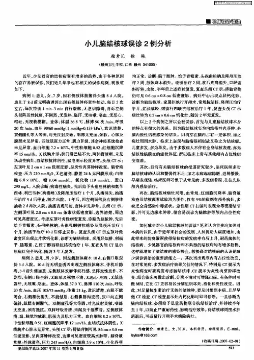 小儿脑结核球误诊2例分析