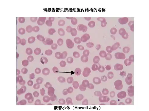 血涂片图谱 ppt课件