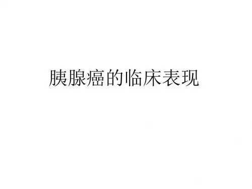 胰腺癌的临床表现