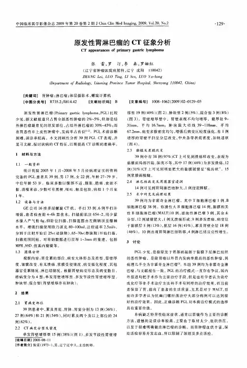 原发性胃淋巴瘤的CT征象分析