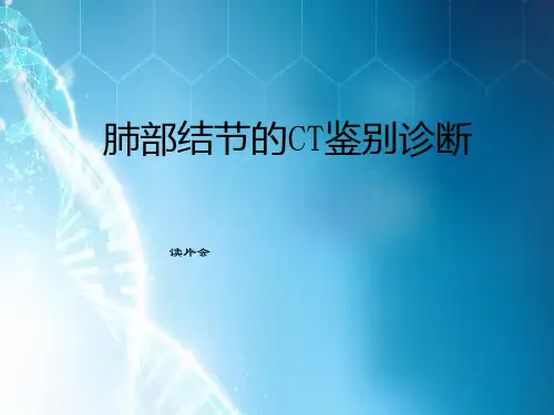 肺部结节的CT鉴别诊断ppt课件