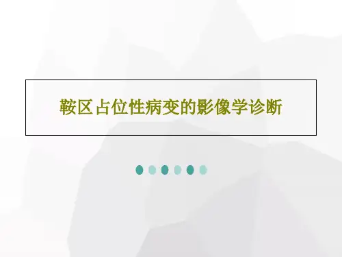 鞍区占位性病变的影像学诊断268页PPT