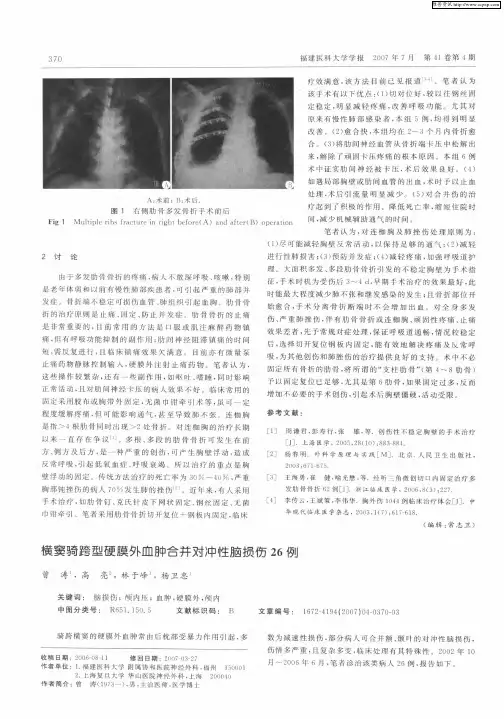 横窦骑跨型硬膜外血肿合并对冲性脑损伤26例