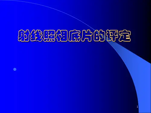 RT评片的标准参考资料