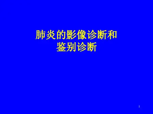 肺炎的影像诊断和鉴别诊断PPT课件