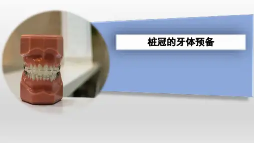 《口腔医学技术》课件——桩冠的牙体预备
