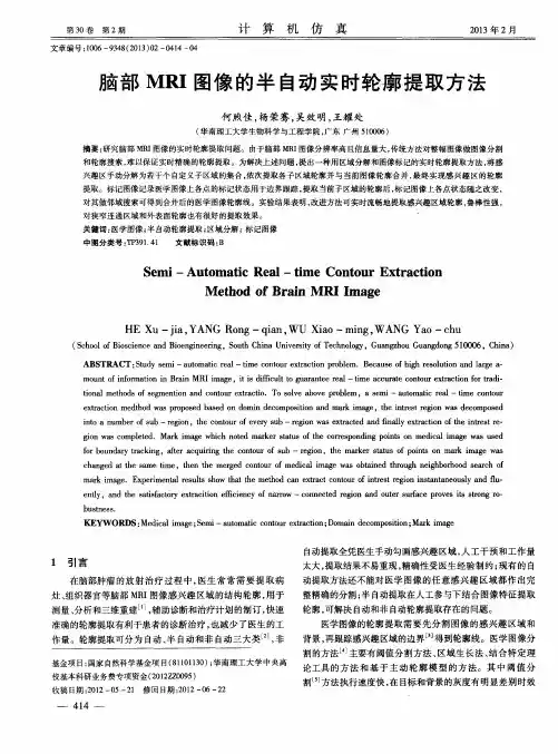 脑部MRI图像的半自动实时轮廓提取方法