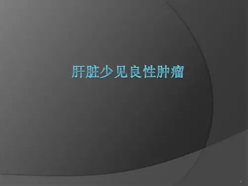 肝脏少见良性肿瘤PPT课件