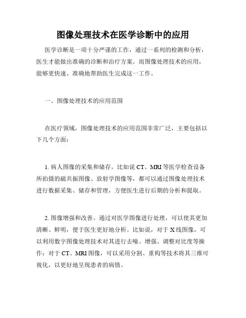 图像处理技术在医学诊断中的应用