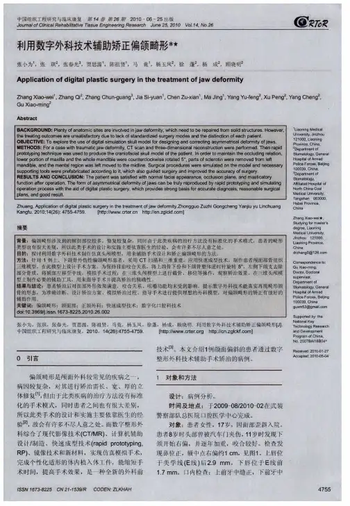 利用数字外科技术辅助矫正偏颌畸形