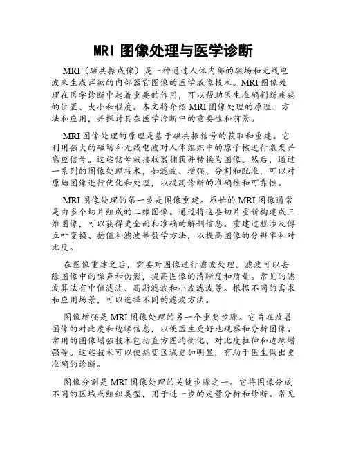 MRI图像处理与医学诊断
