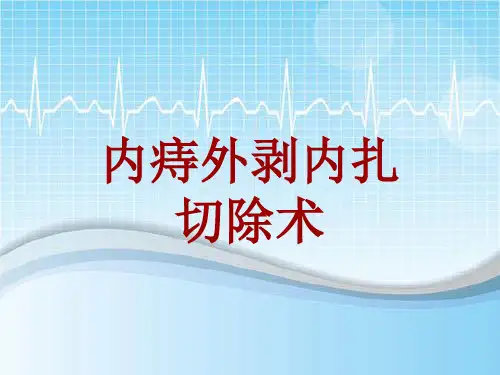 手术讲解模板：内痔外剥内扎切除术