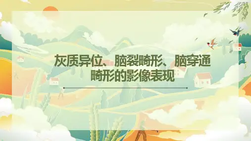 灰质异位、脑裂畸形、脑穿通畸形的影像表现