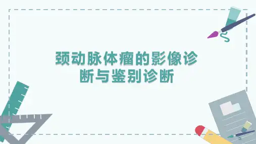 颈动脉体瘤的影像诊断与鉴别诊断