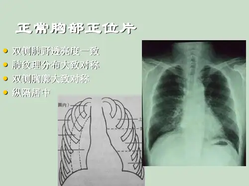 临床执业医师实践技能考试影像学(X线CTB超)精讲全