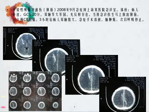 中国颅脑创伤救治指南解读