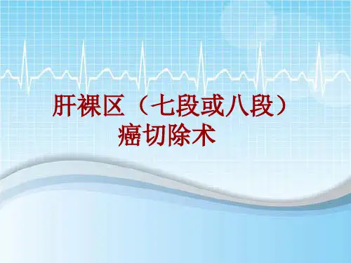 外科手术教学资料：肝裸区(七段或八段)癌切除术讲解模板