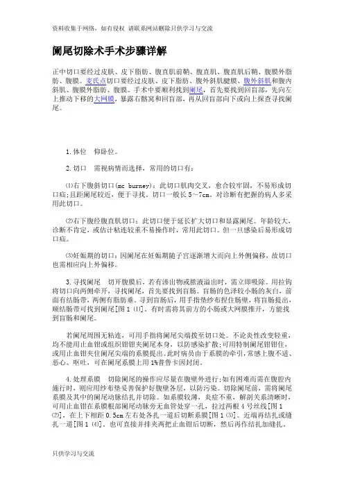 阑尾切除术手术步骤详解54806