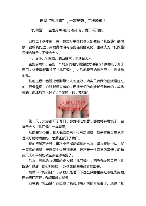 再谈“扎四缝”，一次见效，二次痊愈！