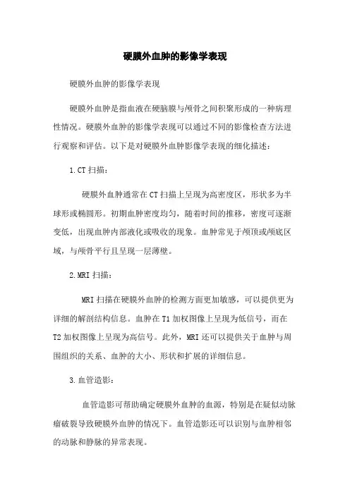 硬膜外血肿的影像学表现