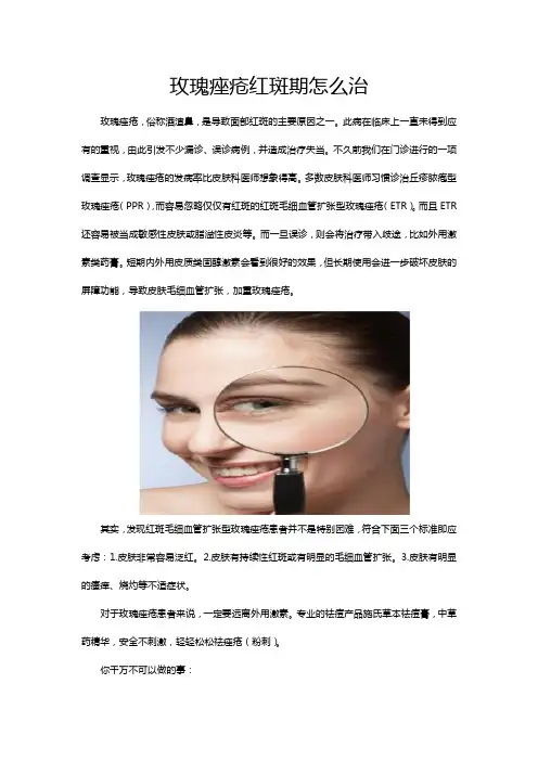 玫瑰痤疮红斑期怎么治