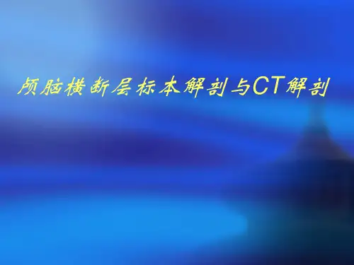 颅脑横断层标本及CT解剖