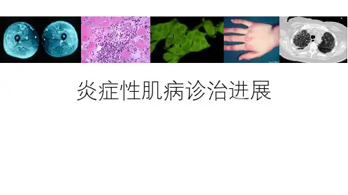 炎症性肌病诊治进展-精品医学课件
