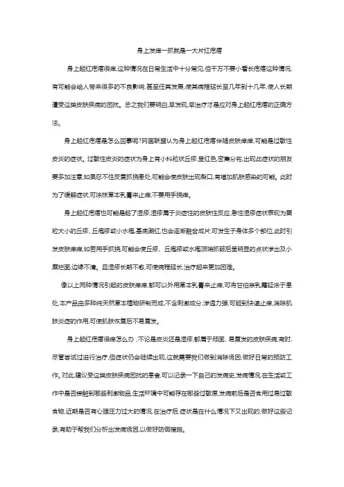 身上发痒一抓就是一大片红疙瘩