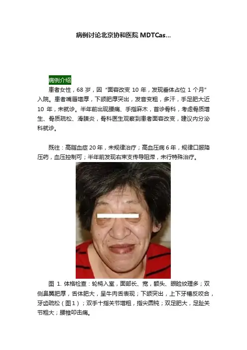 病例讨论北京协和医院MDTCas...
