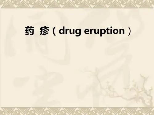 药  疹(drug eruption)