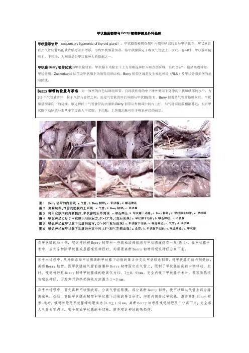 甲状腺悬韧带与Berry韧带解剖及外科处理
