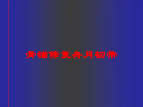 骨锚修复舟月韧带培训课件