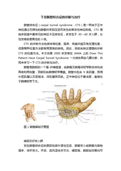 干货腕管综合征的诊断与治疗
