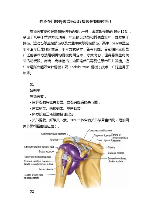 你还在用锁骨钩钢板治疗肩锁关节脱位吗？