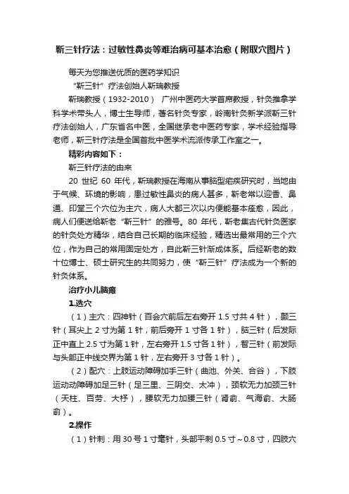 靳三针疗法：过敏性鼻炎等难治病可基本治愈（附取穴图片）