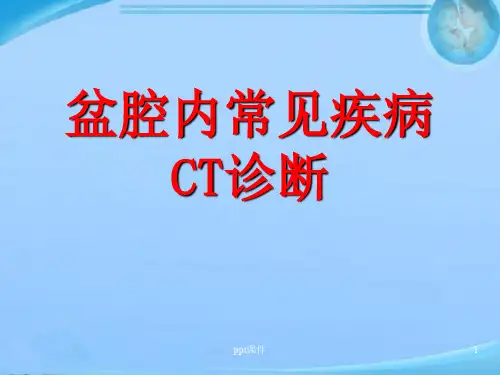 盆腔内常见疾病CT诊断  ppt课件