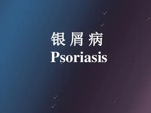 银屑病(课件)ppt