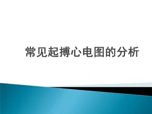 常见起搏心电图的分析